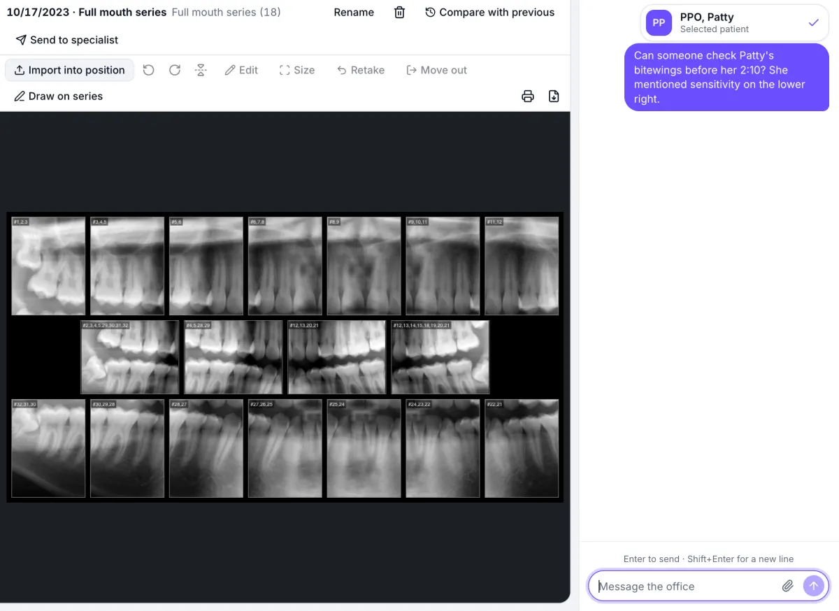 Office chat open beside a full-mouth X-ray series, with a message asking a colleague to check a patient’s bitewings and the patient’s card attached.