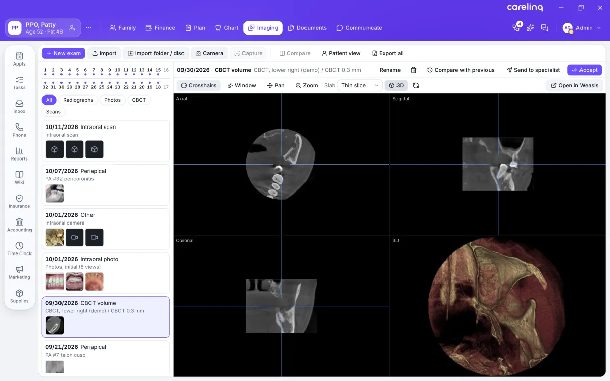 A CBCT volume open in the Imaging module: axial, sagittal and coronal slices with crosshairs, and a 3D volume render, beside the patient’s exam timeline.