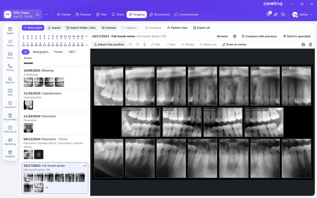 A full-mouth X-ray series in its mount, on an iPad.